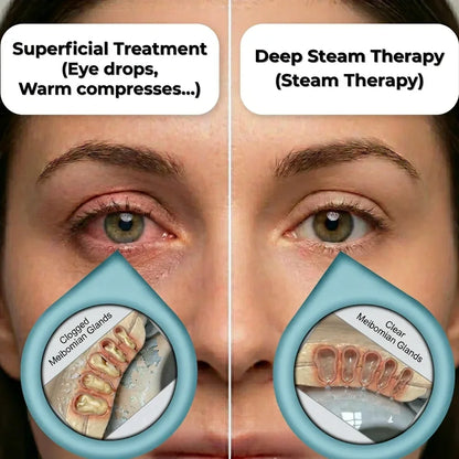 Calmi™ Steam Therapy Device